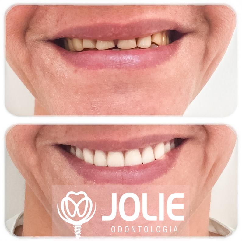 Jolie Implantes Dentista Assefaz